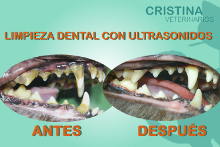 Dental ANTES DESPUES