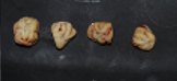 Piedras de oxalato en un gato que no puede orinar